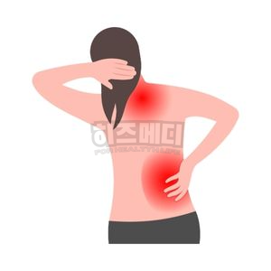 마이코플라스마 폐렴 전염 증상