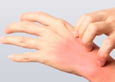 개미환각 증상, 원인, 치료