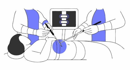 자궁내막증 수술과정