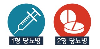 1형 당뇨와 2형 당뇨의 주요 차이점