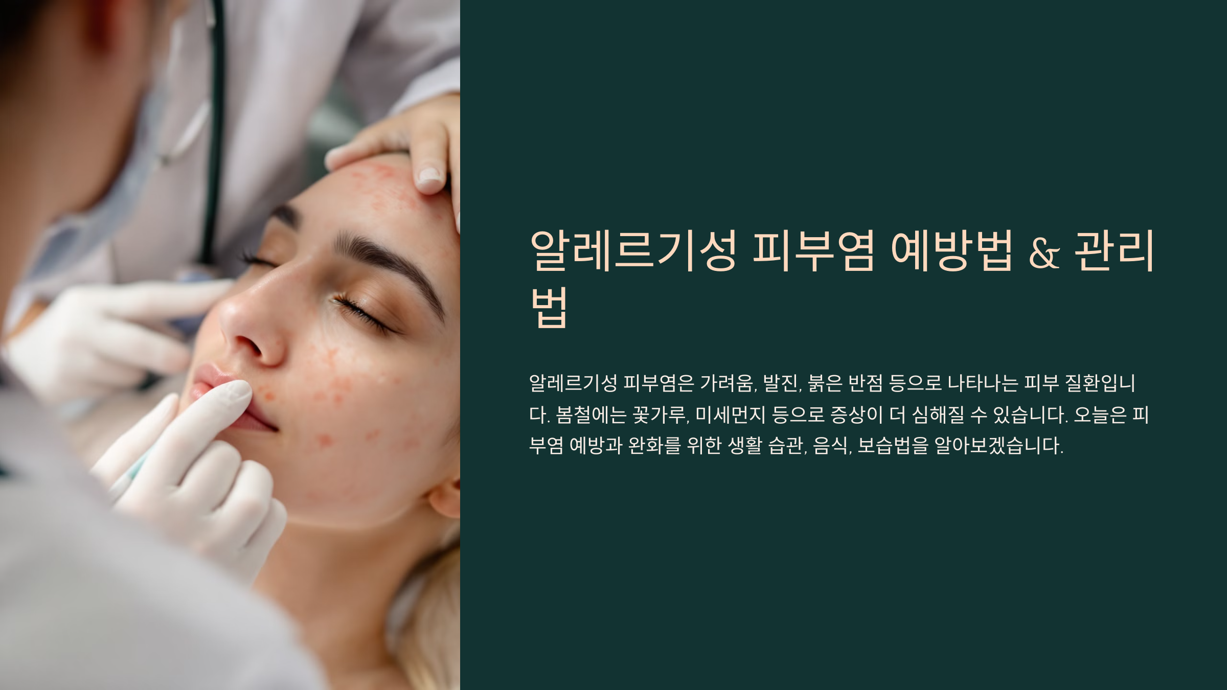 알레르기성 피부염 예방법 &amp; 관리법