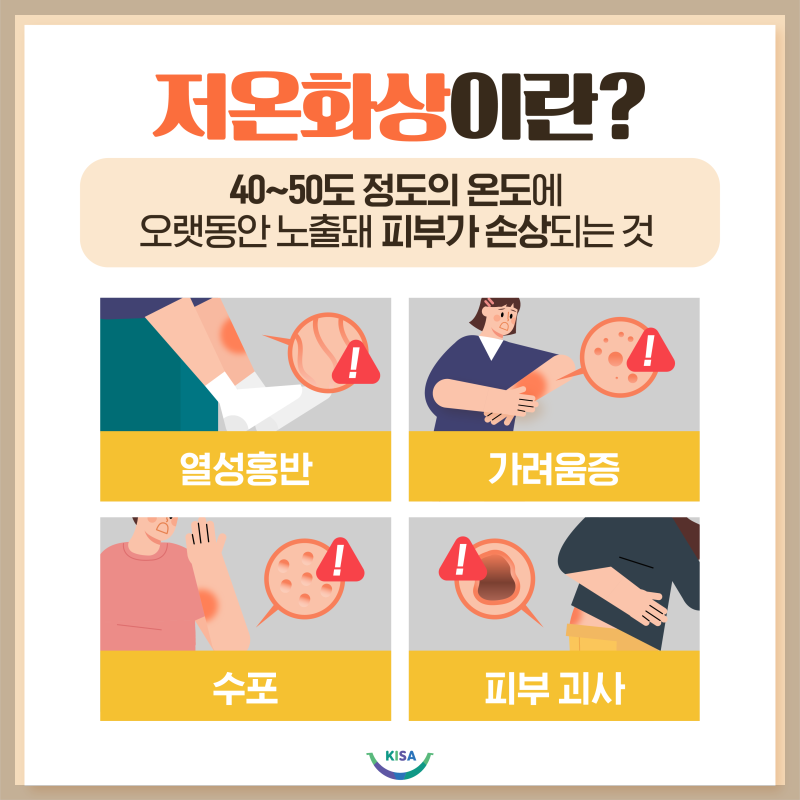 저온화상 증상