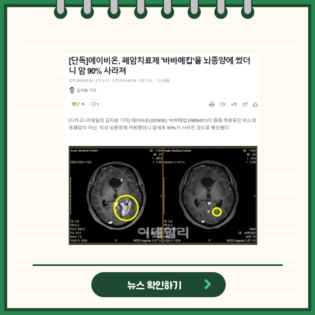 에이비온 뉴스