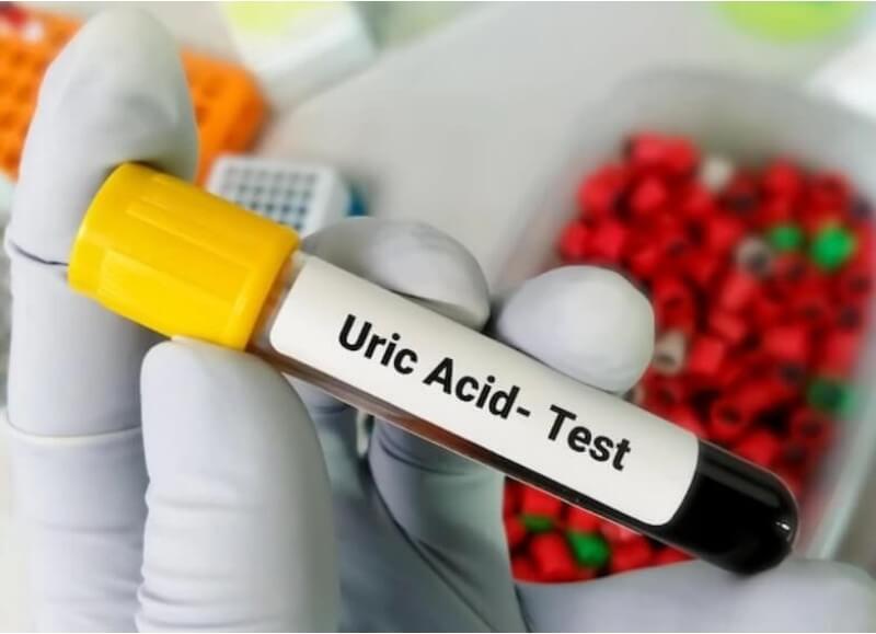 요산수치-정상범위