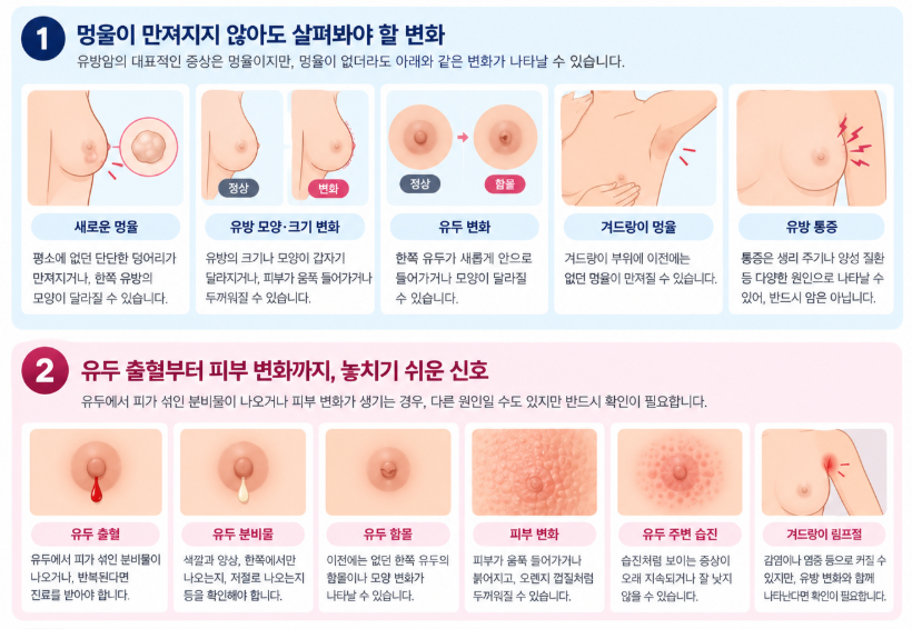 유방암 초기 신호, 멍울만 확인하면 될까?