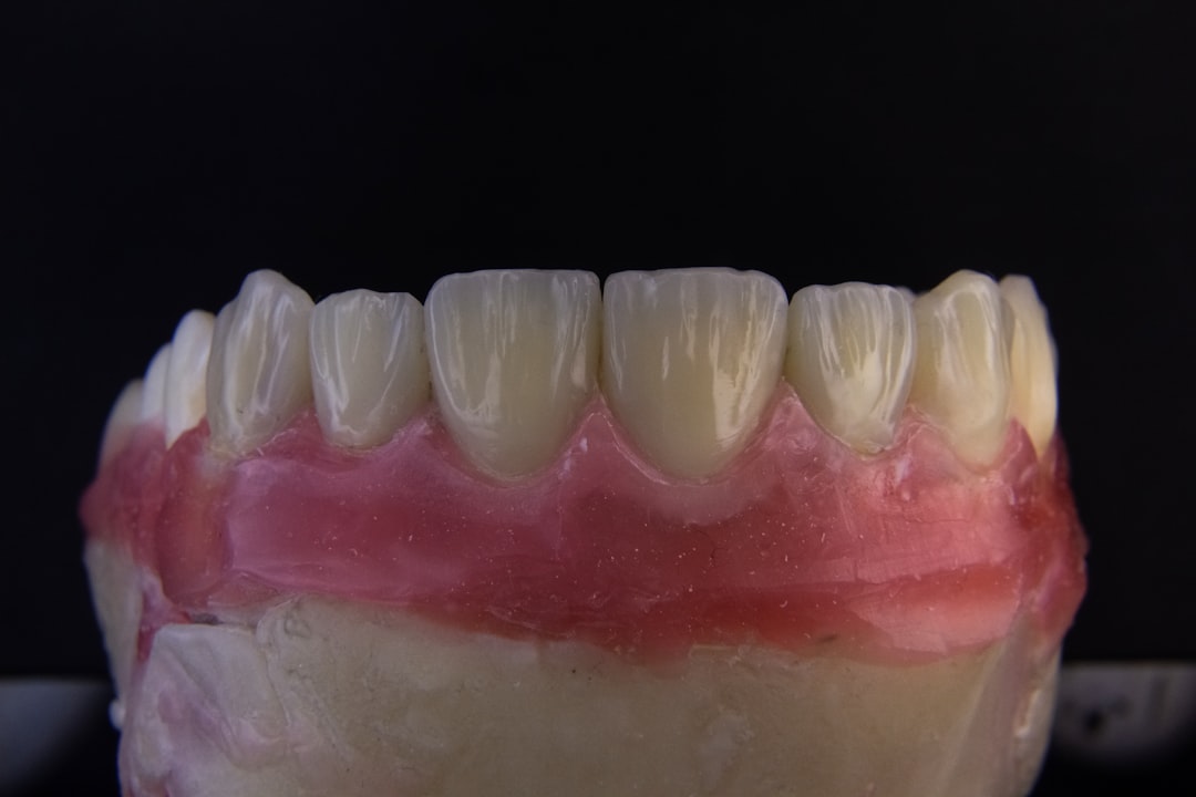 Implant