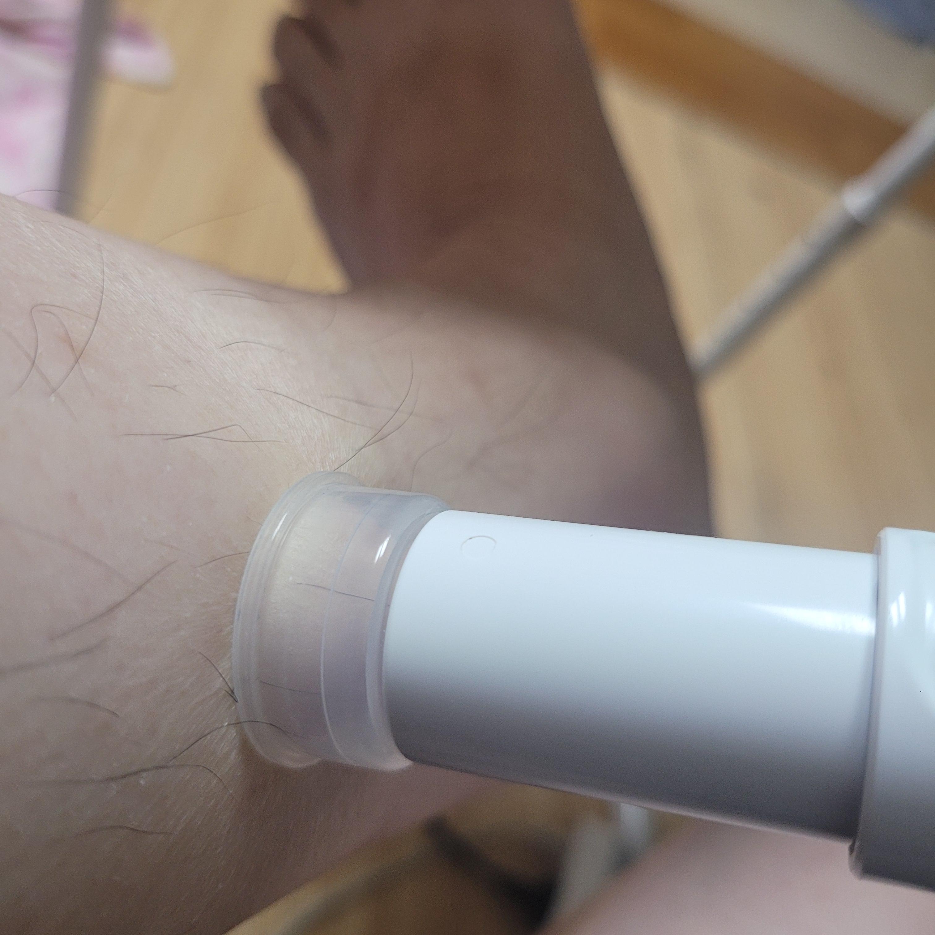 모기침제거기-효과-부황