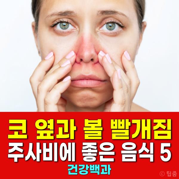 코 옆 볼 빨개짐 주사비 좋은 음식