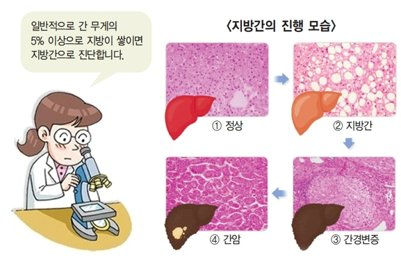 간(9)