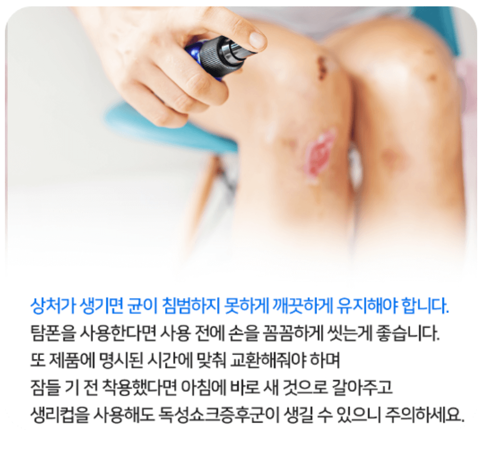 일본 감염병 연쇄구균 독성 쇼크 증후군 치사율 증상 예방법