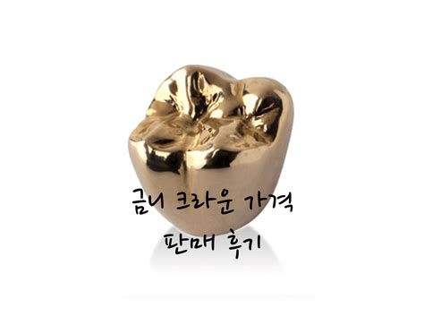 금니가격