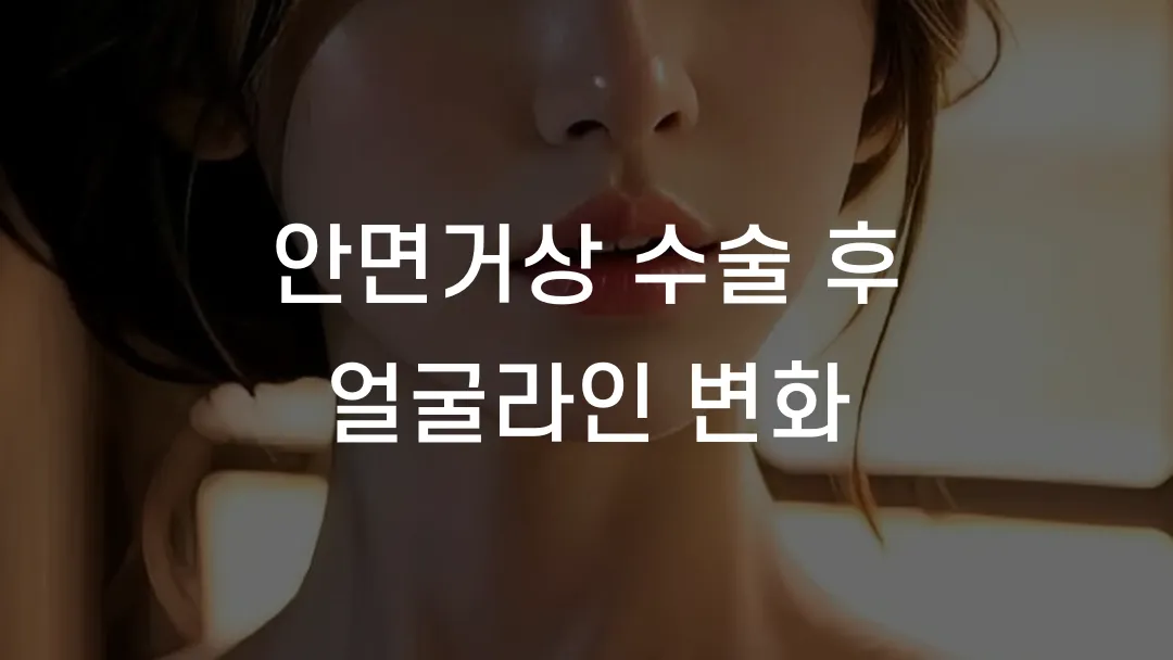 안면거상 수술 후 얼굴라인 변화