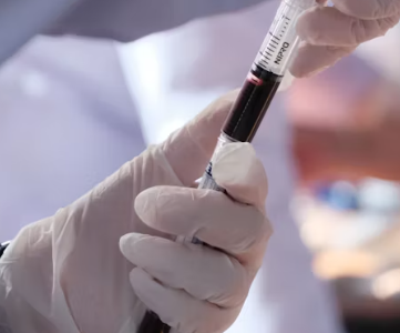 만성 방광염 치료 방법 진단 기준 합병증