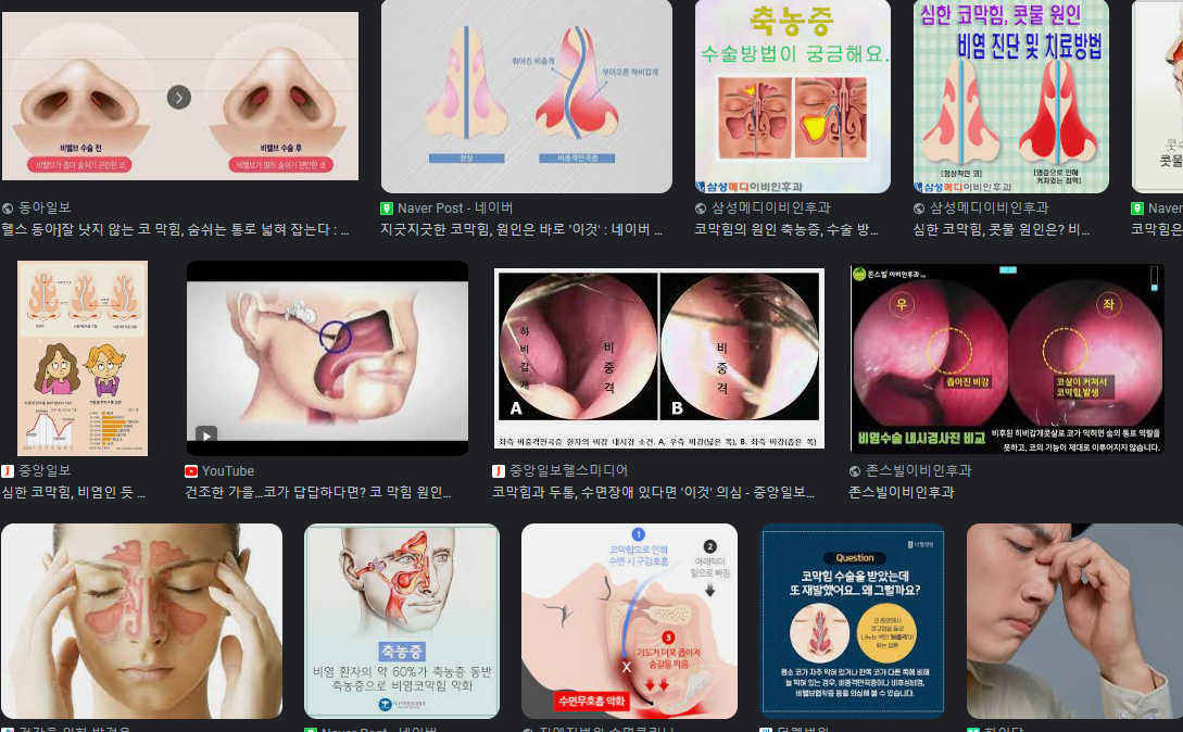 코막힘 뚫는법