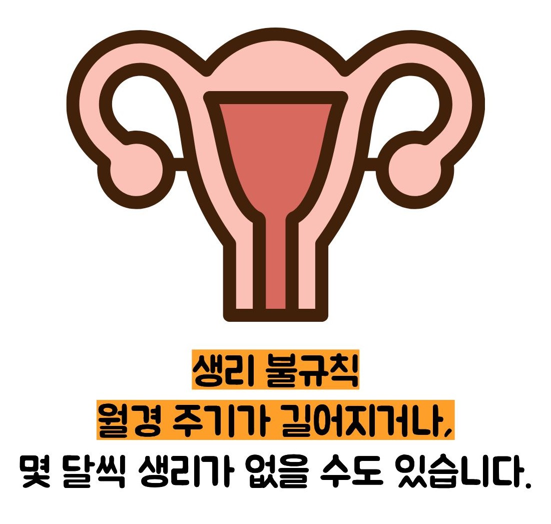 다낭성 난소 증후군 증상