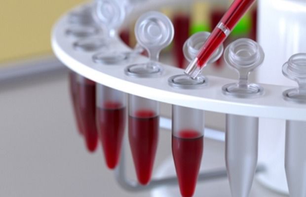 Total Protein 수치