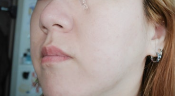 메디인랩 A3앰플 효과