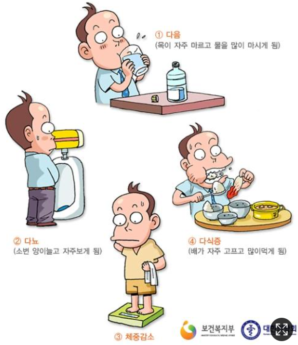 당뇨병의 대표 증상으로는 다음&#44; 다뇨&#44; 다식 그리고 체중감소가 있다.