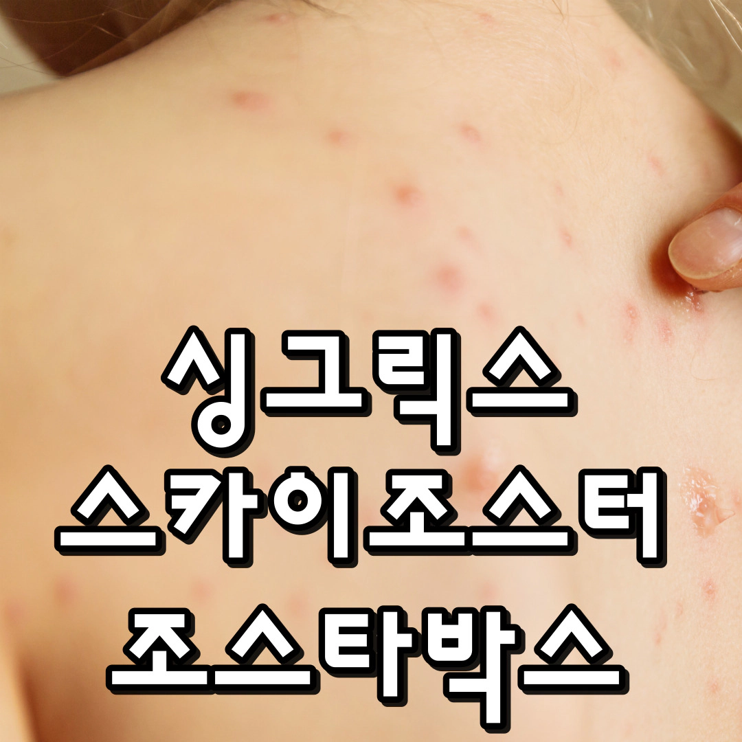 [대상포진 예방접종]싱그릭스vs스카이조스터-조스타박스