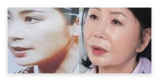 김용선 근황