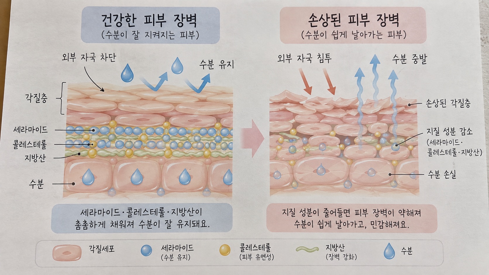 건강한 피부 장벽과 손상된 피부 장벽의 세라마이드 콜레스테롤 지방산 비교