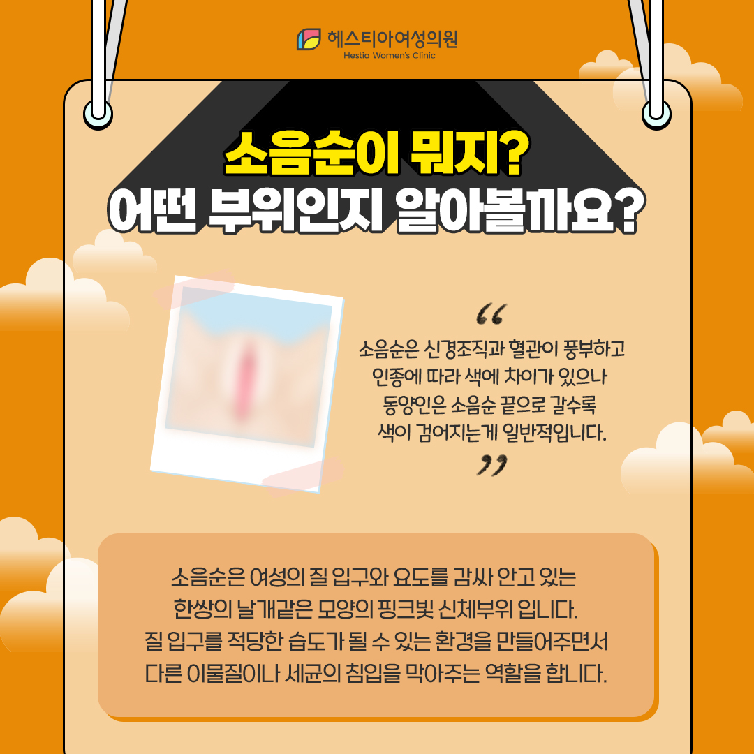 소음순이 뭐지?