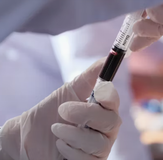 고지혈증 치료법 진단기준 예방