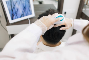 지루성 피부염 완치 원인 샴푸 연고 종류 지루성 피부염 탈모