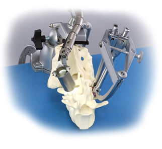 최소 침습 척추경 나사못 후방 고정술 사진 출처: 대한 정형외과 홈페이지