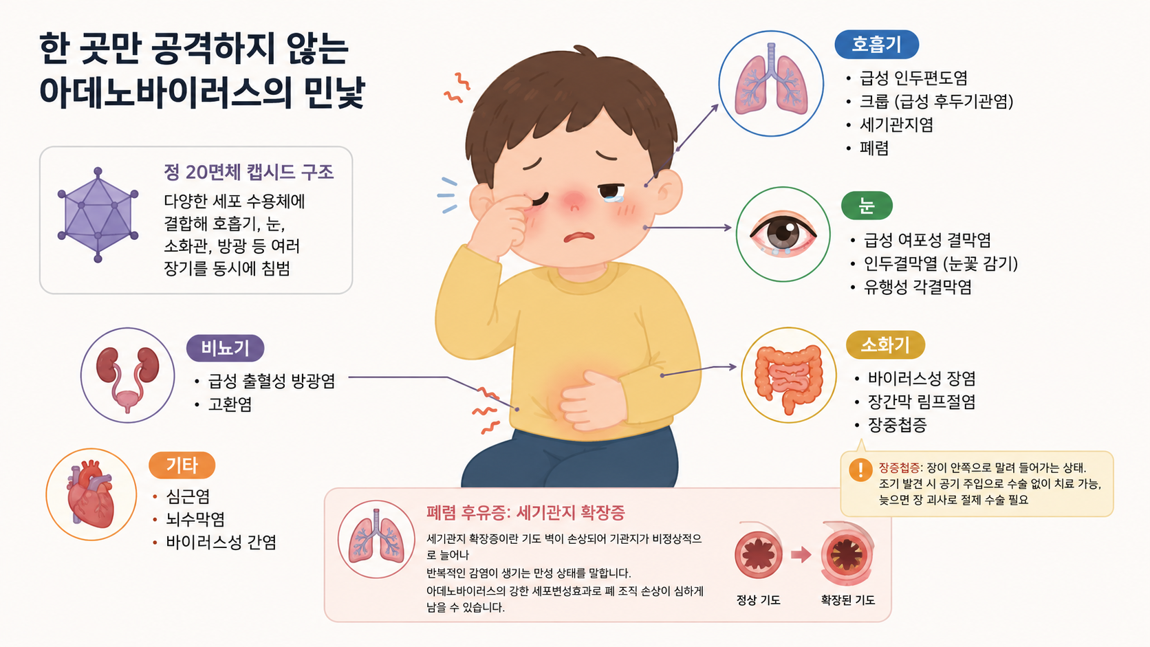 아데노바이러스 (DNA 바이러스, 집단감염, 폐 후유증)