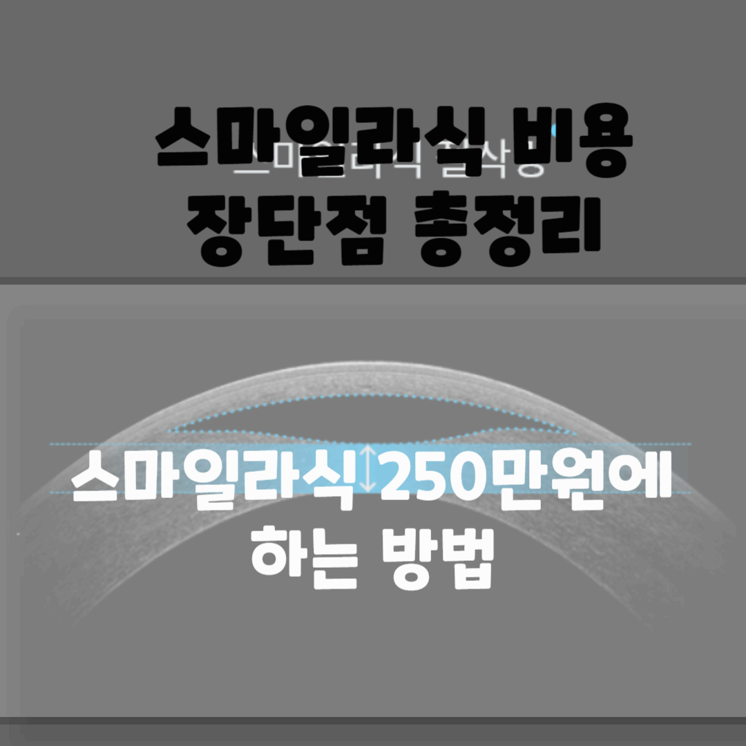 스마일라식 비용, 장점 부작용 총정리 블로그 썸네일 사진