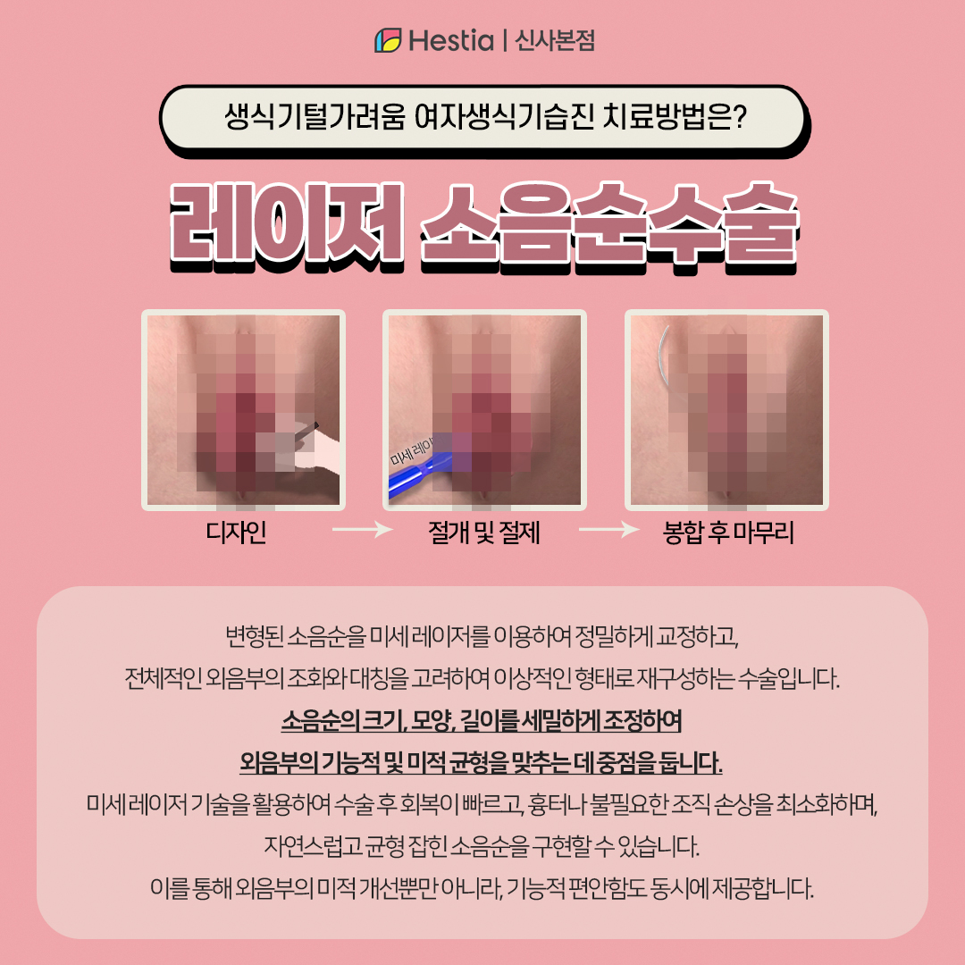 생식기 간지러움, 여자 생식기 습진 치료법은?