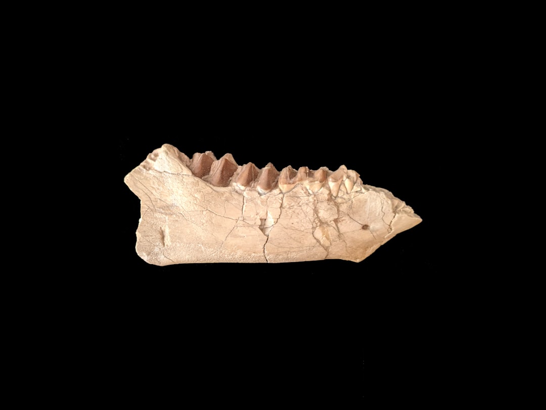 Jaw