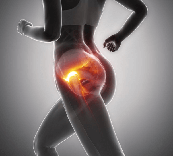 고관절 통증을 느끼는 사람