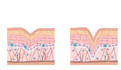 콜라겐의-효능-콜라겐-부작용-건강