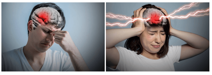 뇌출혈 골든 타임