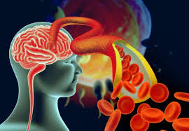 중성지방 정상수치