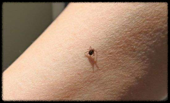 가을철 진드기 감염병 주의보: 예방 방법과 대처 요령