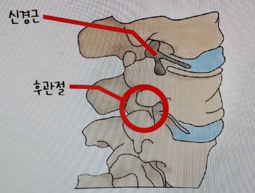 후관절 위치