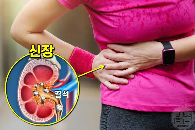 만성탈수 증상,만성탈수 질환,만성탈수 자가진단법,신장결석신부전증,팁줌