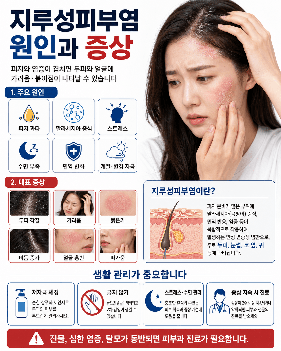 지루성피부염 원인과 증상