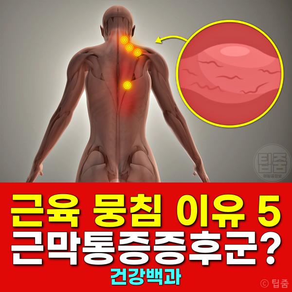 근육 뭉침 원인