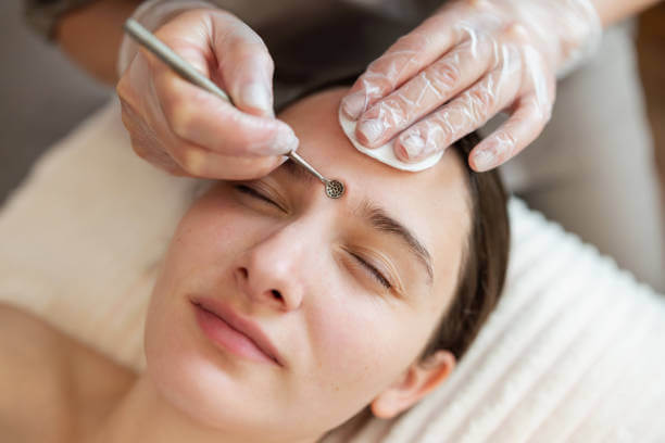 소극성속모증 원인