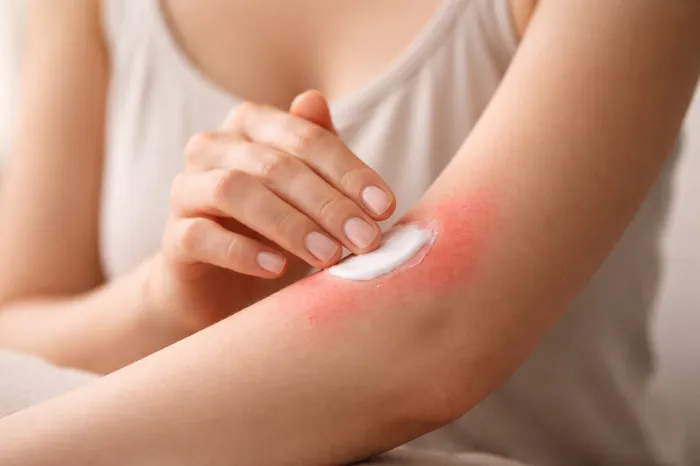 피부에 붉은반점이 생기는 이유