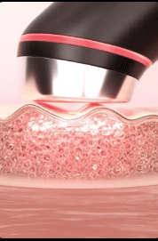 에이피알 &lsquo;메디큐브&rsquo; 