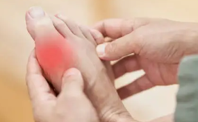 맥주와 통풍 관계