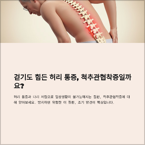 걷기도 힘든 척추관협착증, 조기 발견이 중요합니다