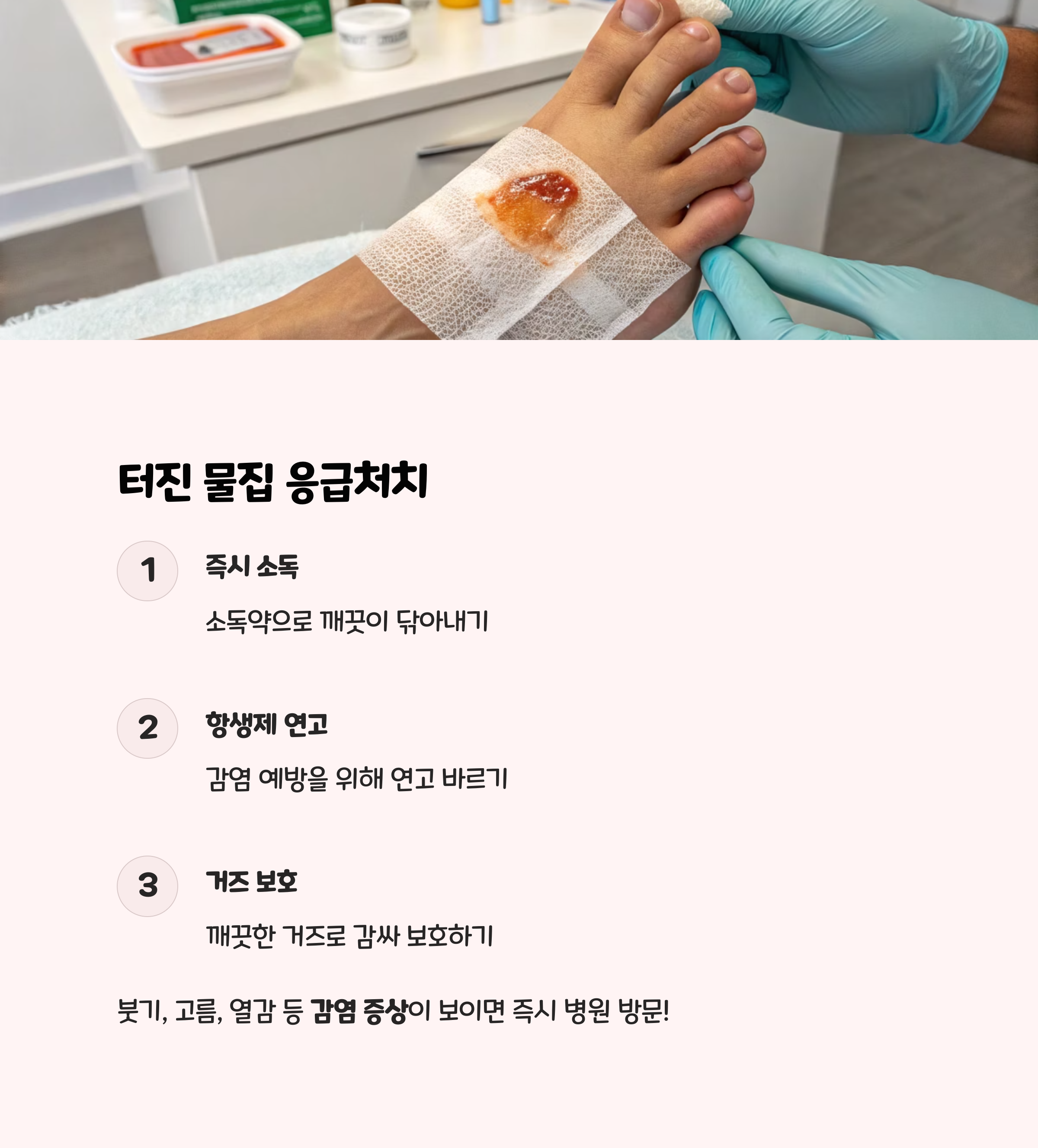 이미 터진 물집 관리법