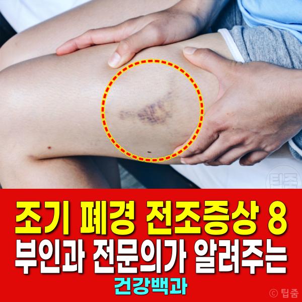 조기 폐경 전조증상