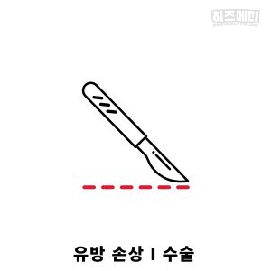 유방 양성석회화
